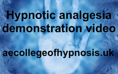 Video of Hypnotic Anaesthesia Demo